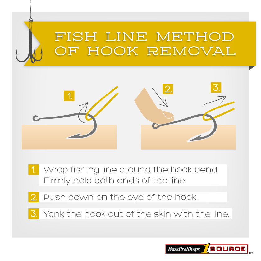 Fish line method of hook removal