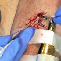 Ouch!