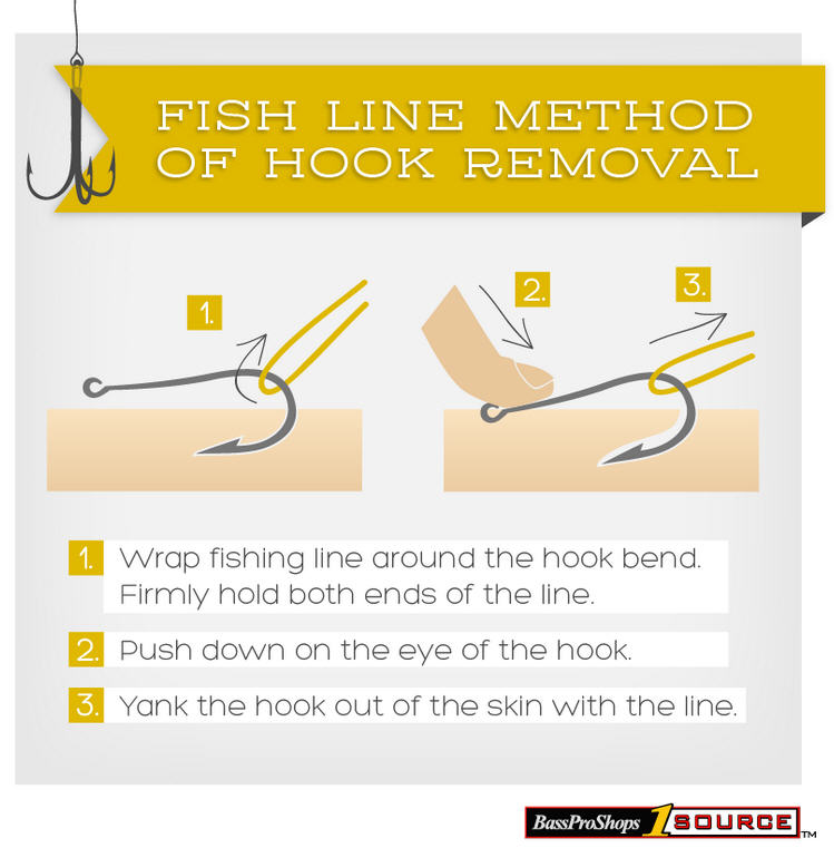 hook removal